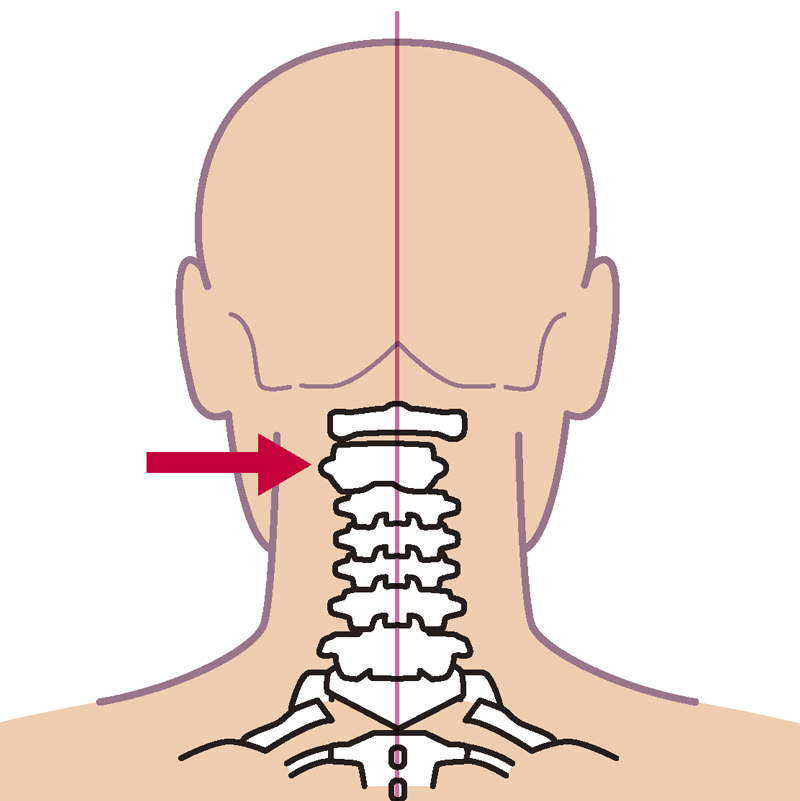 第二頚椎.jpg